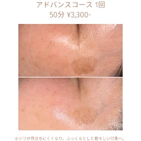 画像1805：エステではなく、ホームケアでお肌をキレイにしました。
