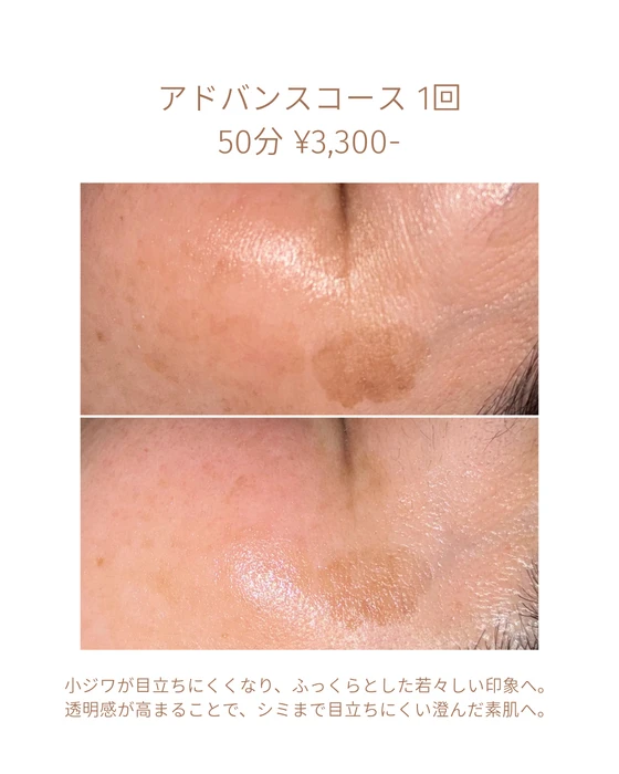 画像1805：エステではなく、ホームケアでお肌をキレイにしました。