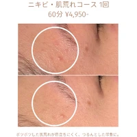 画像1807：エステではなく、ホームケアでお肌をキレイにしました。