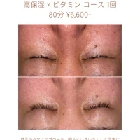 画像1809：エステではなく、ホームケアでお肌をキレイにしました。