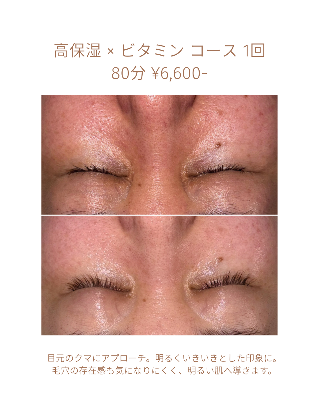 毛穴や目元のくまが目立ちにくく、透明感のある若々しい印象へ。