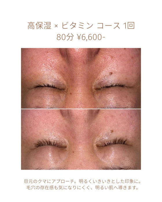 画像1809：エステではなく、ホームケアでお肌をキレイにしました。
