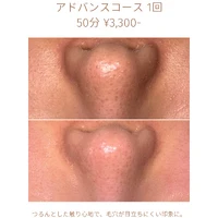 画像1811：エステではなく、ホームケアでお肌をキレイにしました。