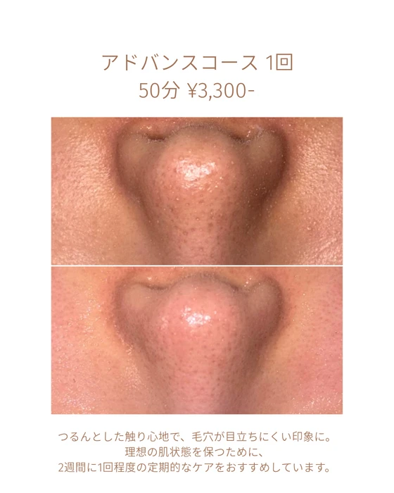 画像1811：エステではなく、ホームケアでお肌をキレイにしました。