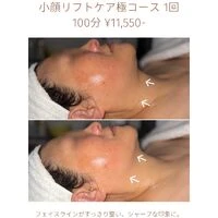 画像1813：エステではなく、ホームケアでお肌をキレイにしました。
