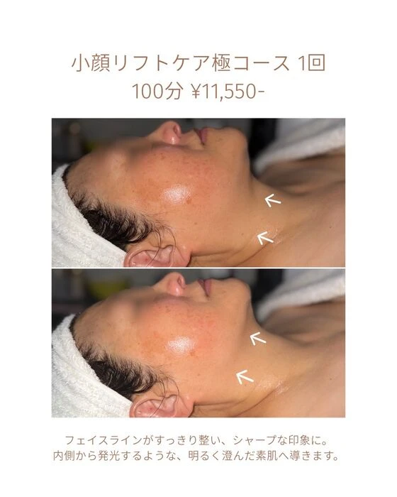 画像1813：エステではなく、ホームケアでお肌をキレイにしました。