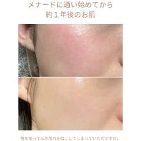 画像1815：エステではなく、ホームケアでお肌をキレイにしました。
