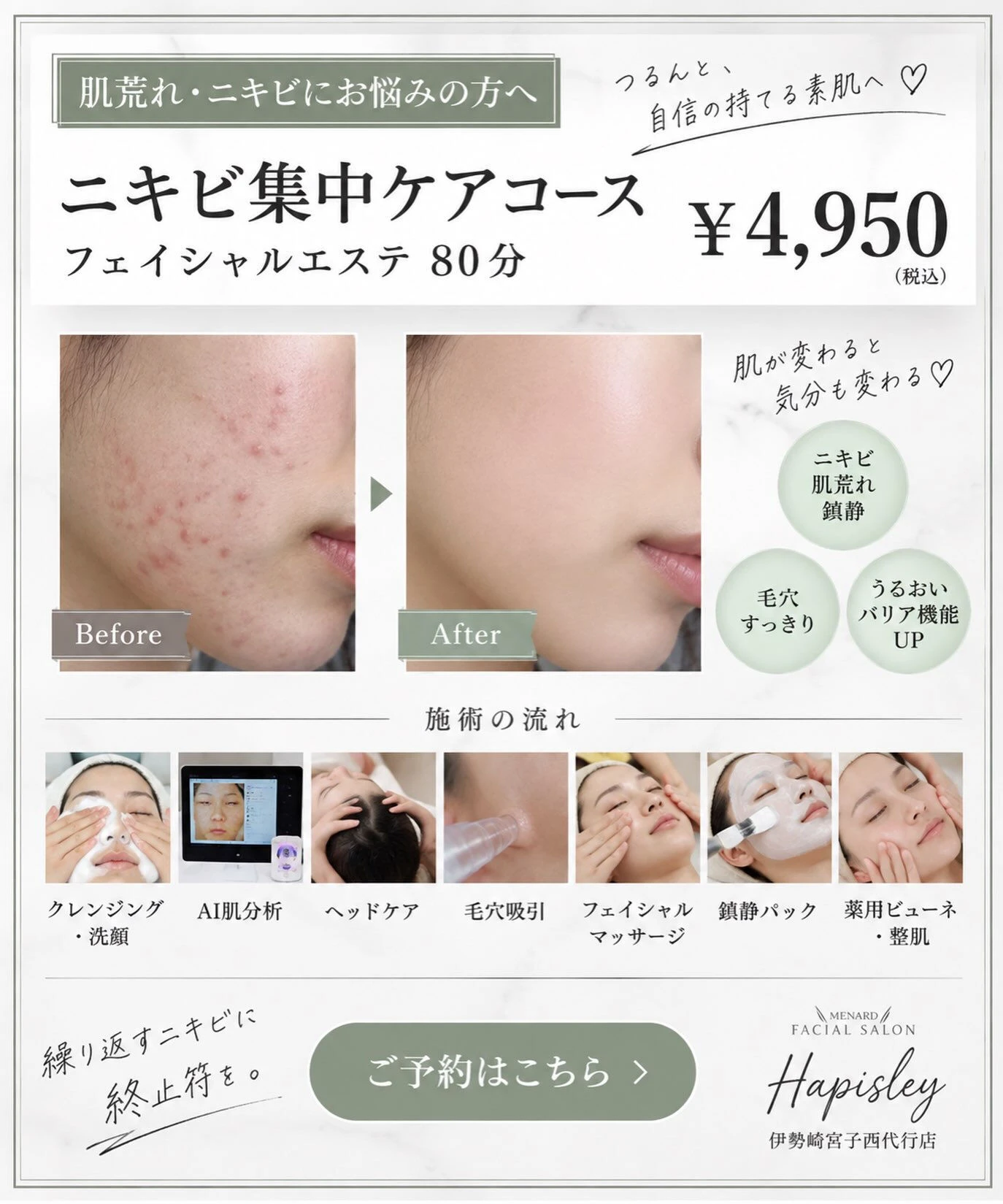 ＼ 繰り返すニキビ・肌荒れに悩んでいる方へ ／